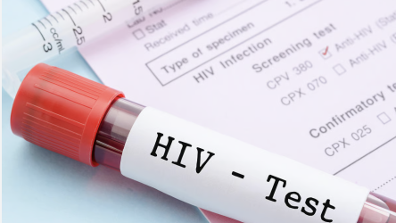 hiv